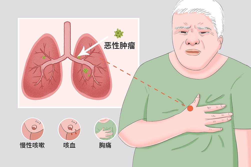 石棉县特殊教育事业单位领导团队最新概述